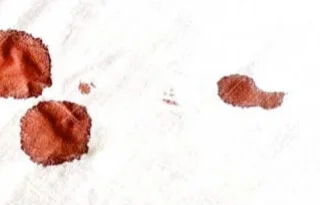 Sangre de chinches de cama